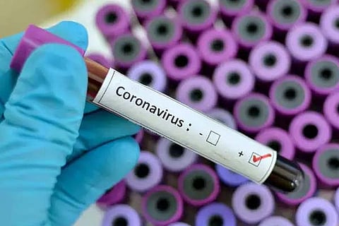 Coronaviurs 9 March 20