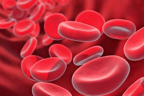 hypercoagulation
