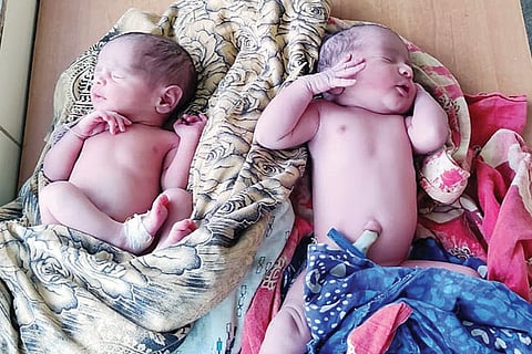 010820 Ballari Corona Women Twins Birth