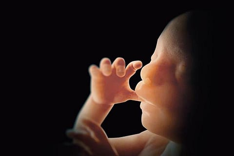 Abortion