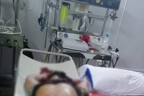 Balloon