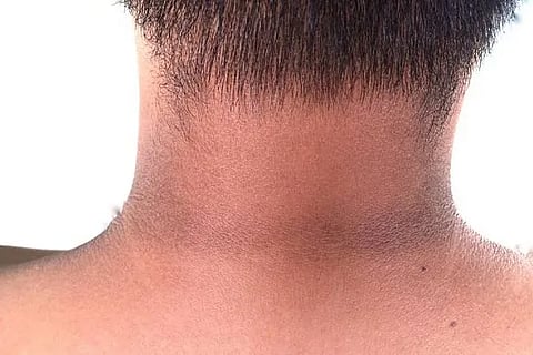 black neck