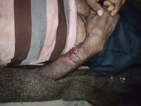 bear attack farmer died