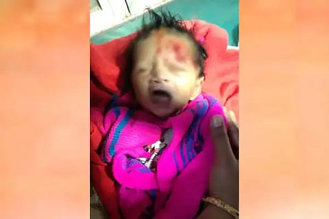 newborn, infant, monkey, attack,