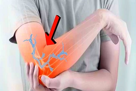 ulnar