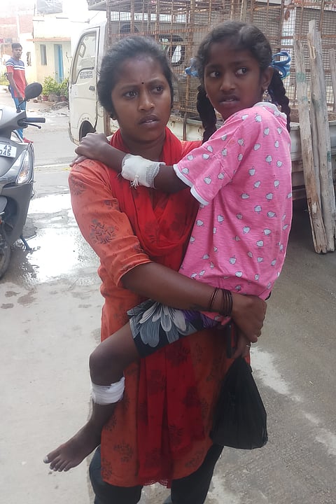 devnalli dogs bite