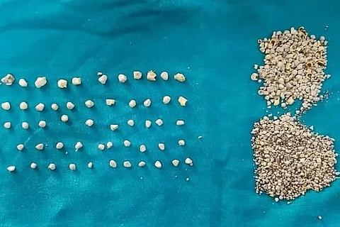 stone