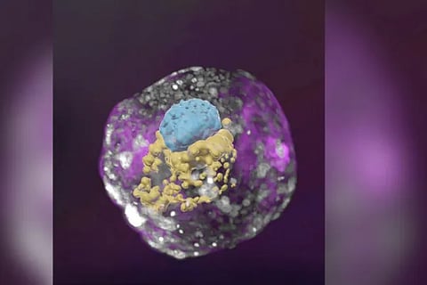 Human Embryo Model
