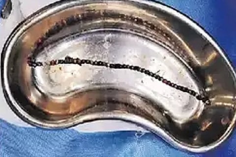 magnet