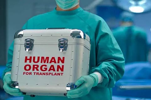 transplant