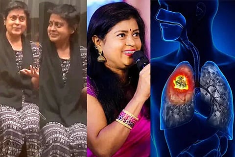 Aparna 1