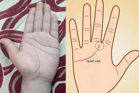 V Symbol on Palm