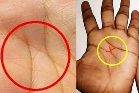 X MARK ON YOUR HAND