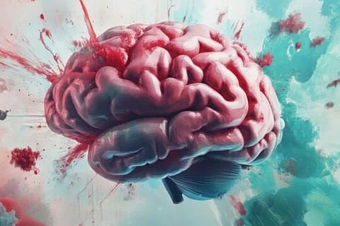 stroke day