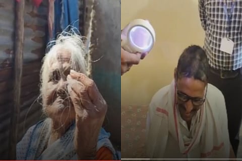 Sudden hair loss among residents of 3 Maharashtra villages sparks panic
