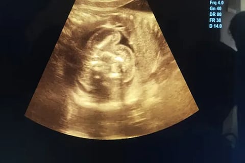 X Ray