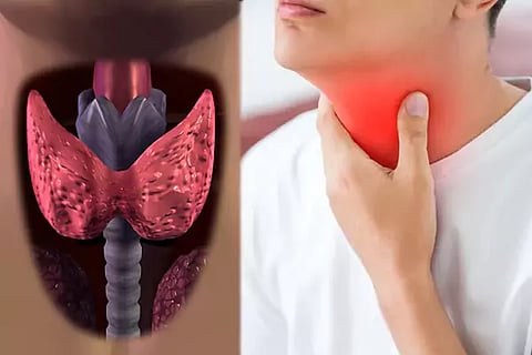 Thyroid