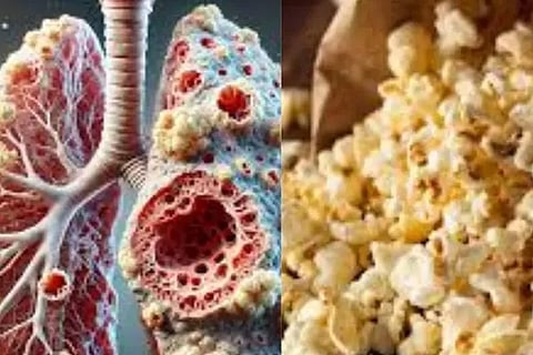 Popcorn