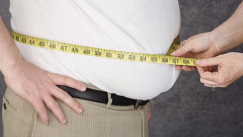 Obesity