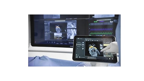 Philips Launches Radiqal Trial to Halve Radiation Exposure in Coronary Procedures