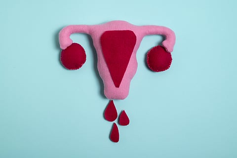 India Faces High Endometriosis Burden, but New Multidisciplinary Model Offers Hope