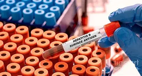 FDA Proposes Ending Routine Hepatitis B Surface Antigen Testing for Blood Donations When Other Tests Are Used