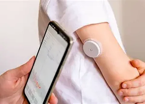Trinity Biotech Achieves Key Milestone for Next-Gen CGM+ System