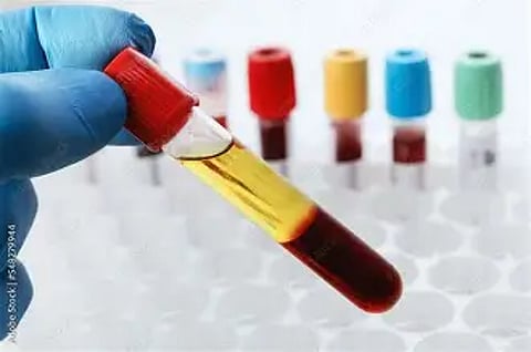 Bal Chander from Himachal Pradesh Secures US Patent for Innovative Blood Analysis System