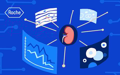 First AI-Based Kidney Risk Stratification Tool