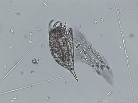Freshwater aquatic zooplankton and algae under microscope view,
