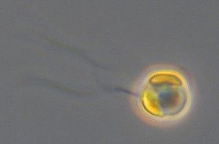Cell of Chrysochromulina leadbeateri seen with differential interference contrast (DIC) light microscopy.