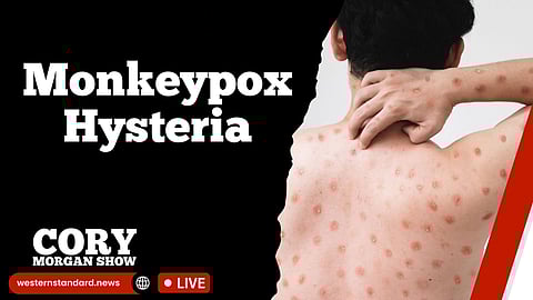 WATCH LIVE: Monkeypox fearmongering is irresponsible