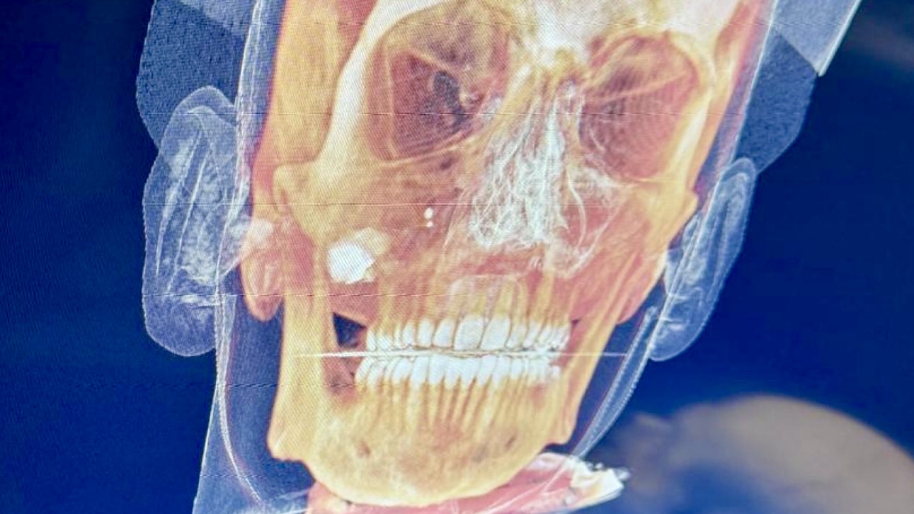A medical scan of the victim