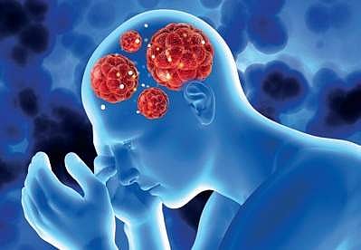 Novel approach for early detection of Parkinson’s disease