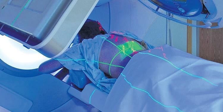 Treating tumours in under a day with radiosurgery treatment