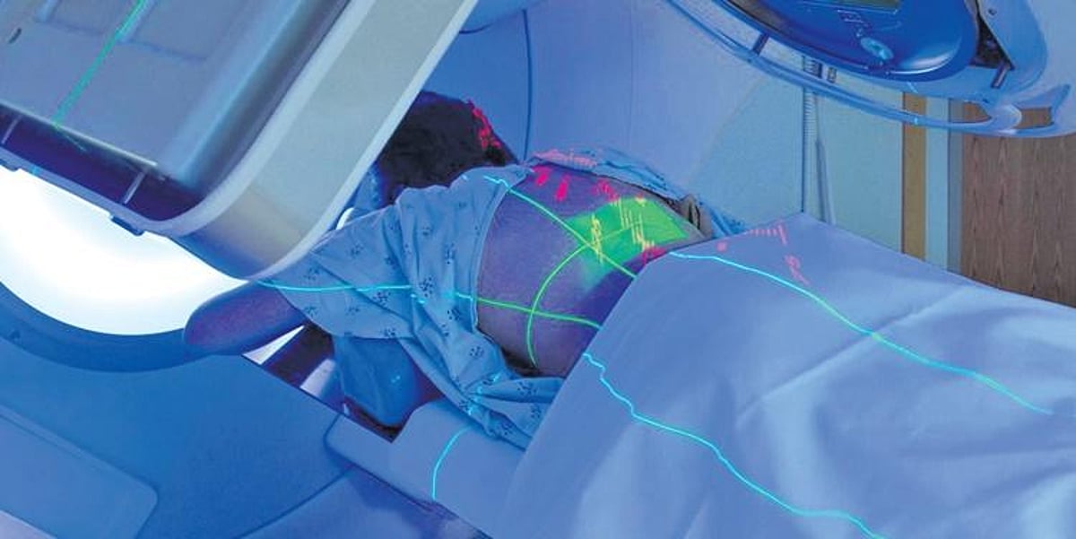 Treating tumours in under a day with radiosurgery treatment