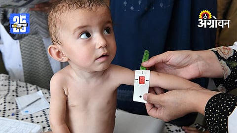 Childrens Malnutrition