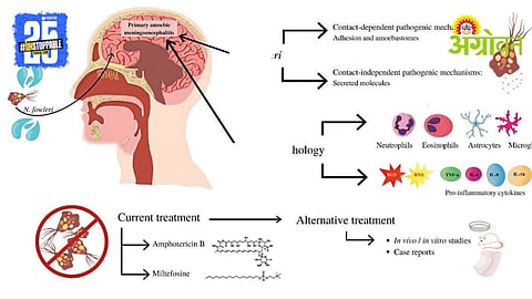 Brain Eating Amoeba