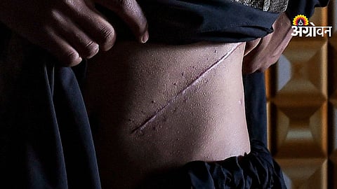 Organ trafficking racket investigation in Maharashtra