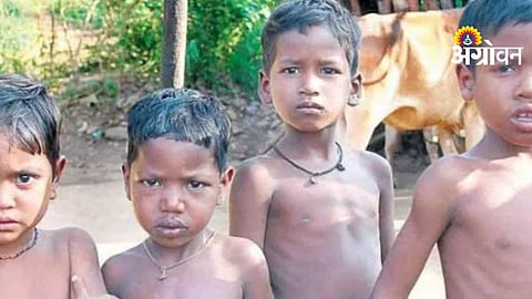 Malnourished Children