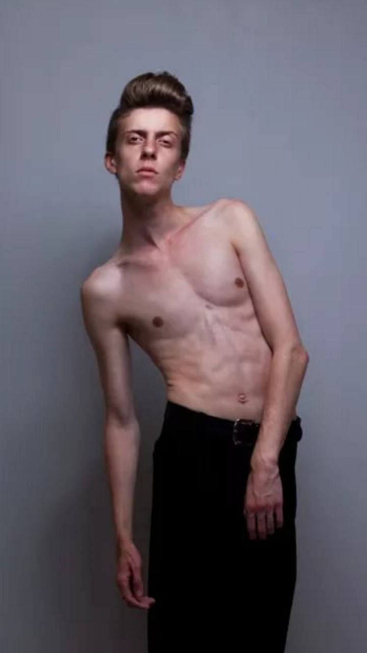 Weight Gain Tips : जाड होण्यासाठी 'हे' आहेत सोपे घरगुती उपाय 2 Weight Gain Tips