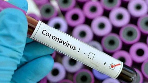 لقاحات كورونا