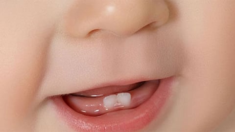 ترتيب ظهور وسقوط أسنان الأطفال
