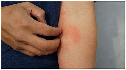 تغيرات تحدث في الجلد