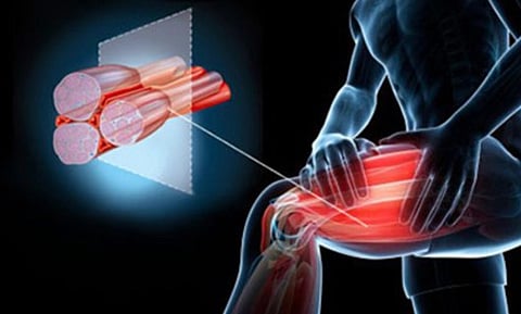 أسباب التشنجات العضلية
