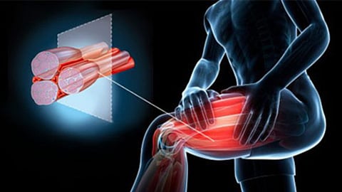 التشنجات العضلية