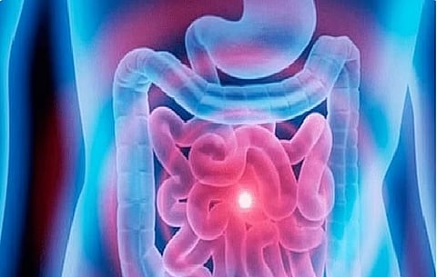 بكتيريا الأمعاء