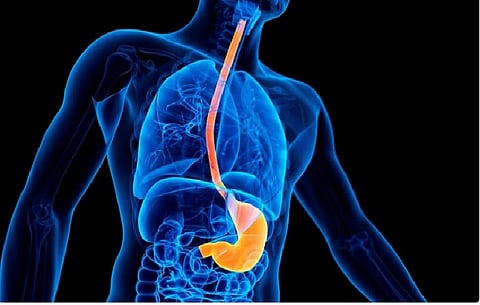 ارتجاع المرئ