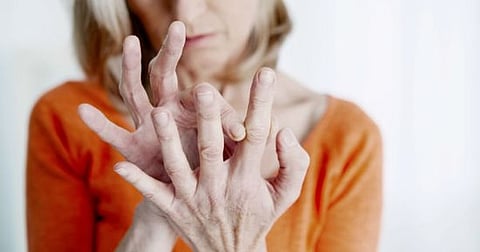 انتفاخ في المفاصل.. ما هي علامات الإصابة بالروماتيزم؟