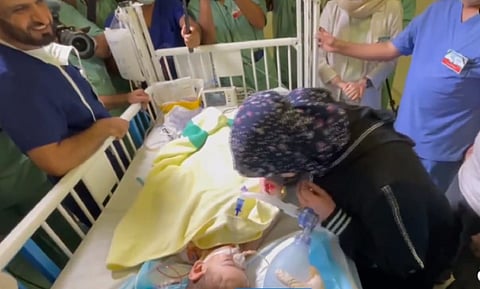 لقاء والدا التوأم السيامي بأحد الطفلين